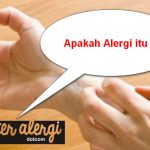 Apakah Alergi itu ?